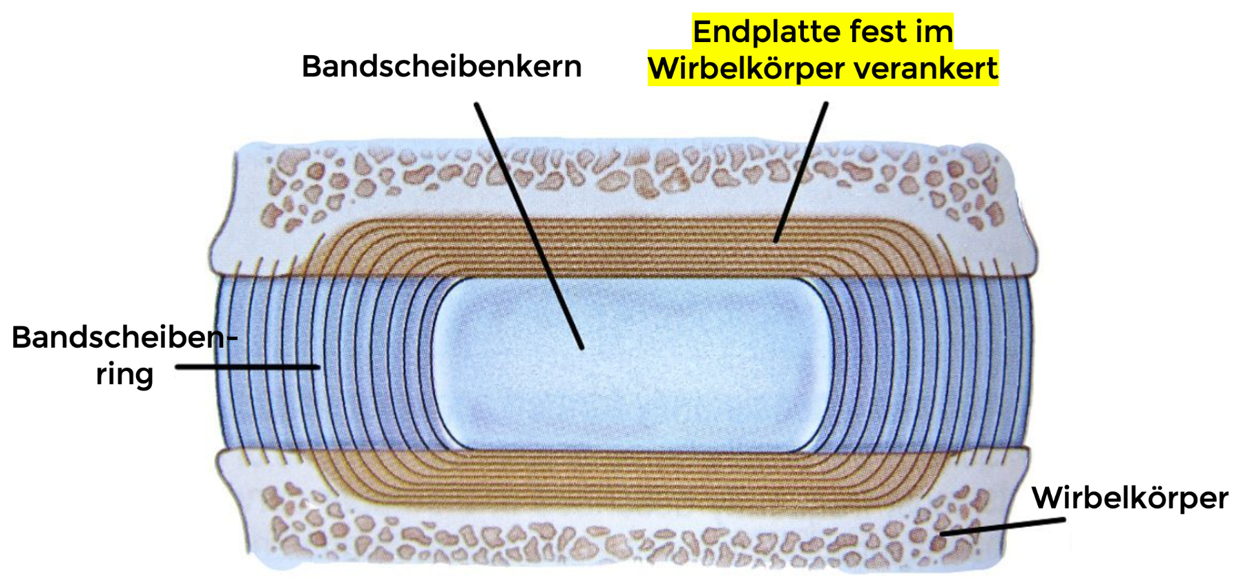 Bandscheibenvorfall