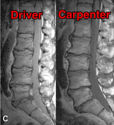 Fahrer (links) - Schreiner (rechts)