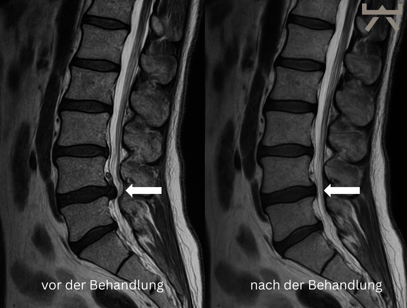 vor der Behandlung vor der Behandlung