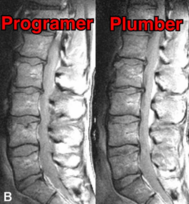 Programmierer (links) - Klempner (rechts)