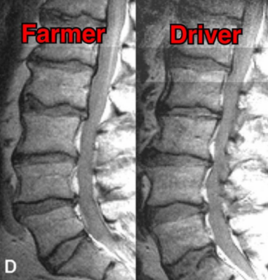 Bauer (links) - Fahrer (rechts)