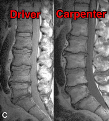 Fahrer (links) - Schreiner (rechts)